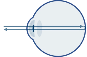 Healthcare-eye-scan Spectroscopy-for-ophthalmology